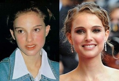 A picture of Natalie Portman before (left) and after (right).